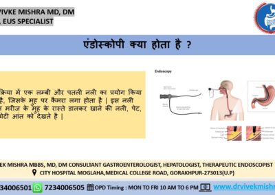 एंडोस्कोपी क्या होता है